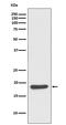 Heat Shock Protein Family B (Small) Member 6 antibody, M07981, Boster Biological Technology, Western Blot image 