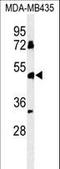 Butyrophilin Like 8 antibody, LS-C156891, Lifespan Biosciences, Western Blot image 