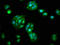 Aldehyde Dehydrogenase 5 Family Member A1 antibody, LS-C369223, Lifespan Biosciences, Immunofluorescence image 