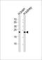 Fibroblast Growth Factor 9 antibody, M02274, Boster Biological Technology, Western Blot image 