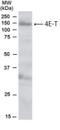 Eukaryotic Translation Initiation Factor 4E Nuclear Import Factor 1 antibody, NB100-1368, Novus Biologicals, Western Blot image 