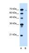 Chloride Channel CLIC Like 1 antibody, NBP1-59834, Novus Biologicals, Western Blot image 