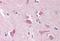 Nicastrin antibody, MBS240394, MyBioSource, Immunohistochemistry paraffin image 