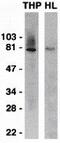 Interleukin 1 Receptor Associated Kinase 1 antibody, GTX31253, GeneTex, Western Blot image 