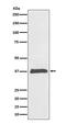Bone Morphogenetic Protein 2 antibody, M00338, Boster Biological Technology, Western Blot image 