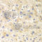 Dynamin 1 Like antibody, A2586, ABclonal Technology, Immunohistochemistry paraffin image 
