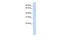 Phosphatidylinositol Glycan Anchor Biosynthesis Class Z antibody, GTX47247, GeneTex, Western Blot image 