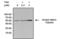 ATP Binding Cassette Subfamily D Member 3 antibody, MA1-2021, Invitrogen Antibodies, Immunoprecipitation image 