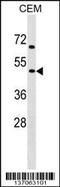 Cholinergic Receptor Nicotinic Gamma Subunit antibody, 58-950, ProSci, Western Blot image 