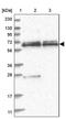 Sperm Associated Antigen 16 antibody, PA5-57995, Invitrogen Antibodies, Western Blot image 