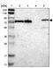 Tetratricopeptide Repeat Domain 14 antibody, PA5-52663, Invitrogen Antibodies, Western Blot image 