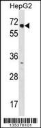 Nuclear Receptor Subfamily 2 Group C Member 1 antibody, 58-293, ProSci, Western Blot image 