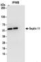 Septin 11 antibody, NBP2-32159, Novus Biologicals, Immunoprecipitation image 