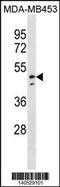 NADH:Ubiquinone Oxidoreductase Core Subunit V1 antibody, 60-532, ProSci, Western Blot image 