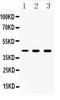 Tyrosine Aminotransferase antibody, PA5-80097, Invitrogen Antibodies, Western Blot image 