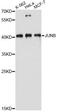 JunB Proto-Oncogene, AP-1 Transcription Factor Subunit antibody, A14566, ABclonal Technology, Western Blot image 