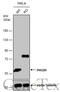 Phosphoglycerate Dehydrogenase antibody, GTX101949, GeneTex, Western Blot image 