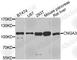 Cyclic Nucleotide Gated Channel Alpha 3 antibody, A6888, ABclonal Technology, Western Blot image 