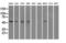 Fumarate Hydratase antibody, GTX84499, GeneTex, Western Blot image 