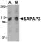 DLG Associated Protein 3 antibody, A14041, Boster Biological Technology, Western Blot image 