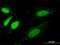 Sorting Nexin 20 antibody, H00124460-M05, Novus Biologicals, Immunofluorescence image 