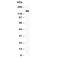 Selectin P antibody, R30805, NSJ Bioreagents, Western Blot image 