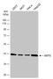 Glutamic-Oxaloacetic Transaminase 2 antibody, GTX101930, GeneTex, Western Blot image 