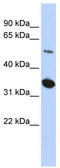 Abraxas 2, BRISC Complex Subunit antibody, TA333622, Origene, Western Blot image 