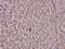 Hepatocyte Nuclear Factor 4 Alpha antibody, A00389S313, Boster Biological Technology, Immunohistochemistry paraffin image 