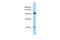 Cartilage Intermediate Layer Protein 2 antibody, A12399, Boster Biological Technology, Western Blot image 