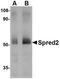 Sprouty Related EVH1 Domain Containing 2 antibody, NBP1-76342, Novus Biologicals, Western Blot image 