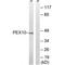 Peroxisomal Biogenesis Factor 10 antibody, PA5-50085, Invitrogen Antibodies, Western Blot image 