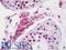 Retinoid X Receptor Alpha antibody, LS-B10701, Lifespan Biosciences, Immunohistochemistry paraffin image 