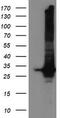 Glutathione S-Transferase Theta 2 (Gene/Pseudogene) antibody, TA501832, Origene, Western Blot image 