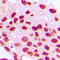Homeobox C6 antibody, LS-C356106, Lifespan Biosciences, Immunohistochemistry paraffin image 