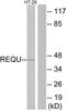 Double PHD Fingers 2 antibody, A30539, Boster Biological Technology, Western Blot image 