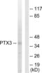 Pentraxin-related protein PTX3 antibody, abx013442, Abbexa, Western Blot image 