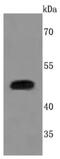 Plasminogen Activator, Urokinase antibody, NBP2-66766, Novus Biologicals, Western Blot image 