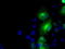 Betaine--Homocysteine S-Methyltransferase antibody, M06712-1, Boster Biological Technology, Western Blot image 