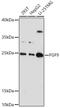 Fibroblast Growth Factor 9 antibody, GTX55621, GeneTex, Western Blot image 