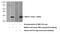 NME/NM23 Nucleoside Diphosphate Kinase 6 antibody, 10250-1-AP, Proteintech Group, Western Blot image 