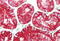 Aquaporin 1 (Colton Blood Group) antibody, MBS247992, MyBioSource, Immunohistochemistry paraffin image 