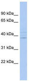IQ Motif Containing K antibody, TA337854, Origene, Western Blot image 