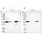 3-Hydroxyisobutyryl-CoA Hydrolase antibody, PA5-57710, Invitrogen Antibodies, Western Blot image 