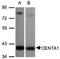 ArfGAP With Dual PH Domains 1 antibody, NBP1-31179, Novus Biologicals, Western Blot image 