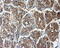 Deoxynucleotidyltransferase Terminal Interacting Protein 1 antibody, M09745, Boster Biological Technology, Immunohistochemistry paraffin image 