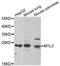 Ventricular/slow twitch myosin alkali light chain antibody, A6662, ABclonal Technology, Western Blot image 