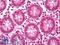 Protein Tyrosine Kinase 2 antibody, LS-B7154, Lifespan Biosciences, Immunohistochemistry paraffin image 