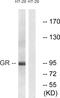 Nuclear Receptor Subfamily 3 Group C Member 1 antibody, LS-C117566, Lifespan Biosciences, Western Blot image 