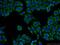 G Protein Subunit Beta 3 antibody, 10081-1-AP, Proteintech Group, Immunofluorescence image 